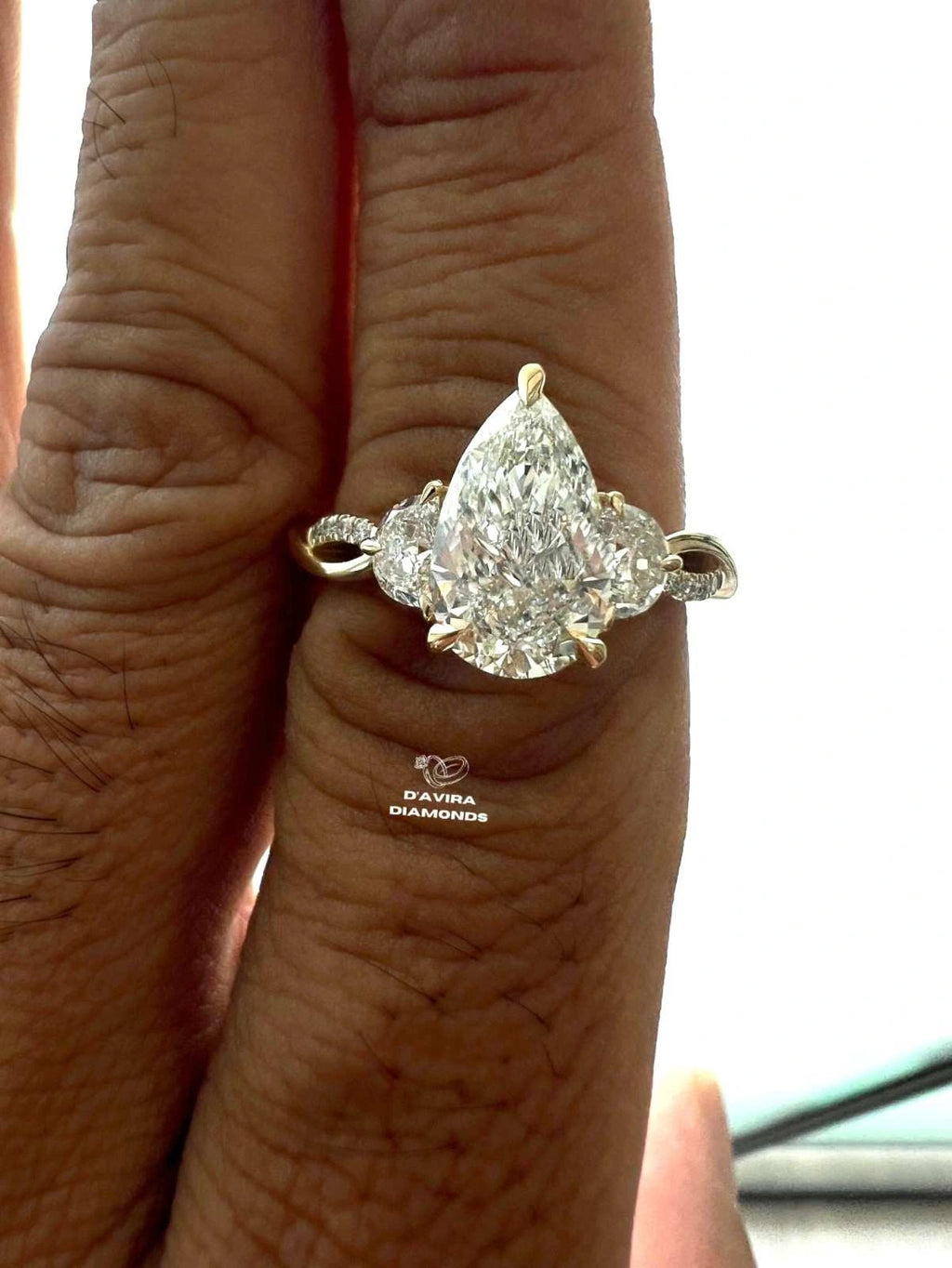 A close-up of a hand wearing a diamond ring 