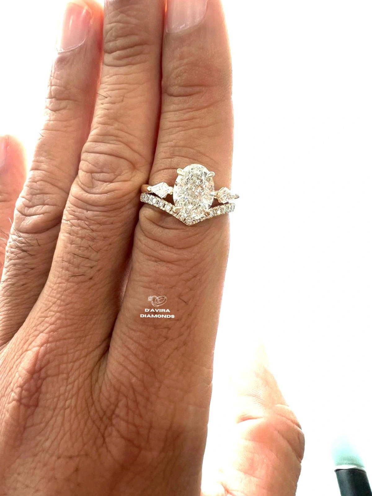 A close-up of a hand wearing a white gold engagement ring